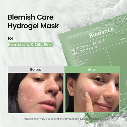 BIODANCE Bio-Collagen Real Deep Mask, Hydrating Overnight Hydrogel Face Mask, Pore Minimizing, Elasticity, Plumping, Travel Essentials & Self Care Gifts for Women, Korean Skin Care | 1.19oz(34g) x 4ea