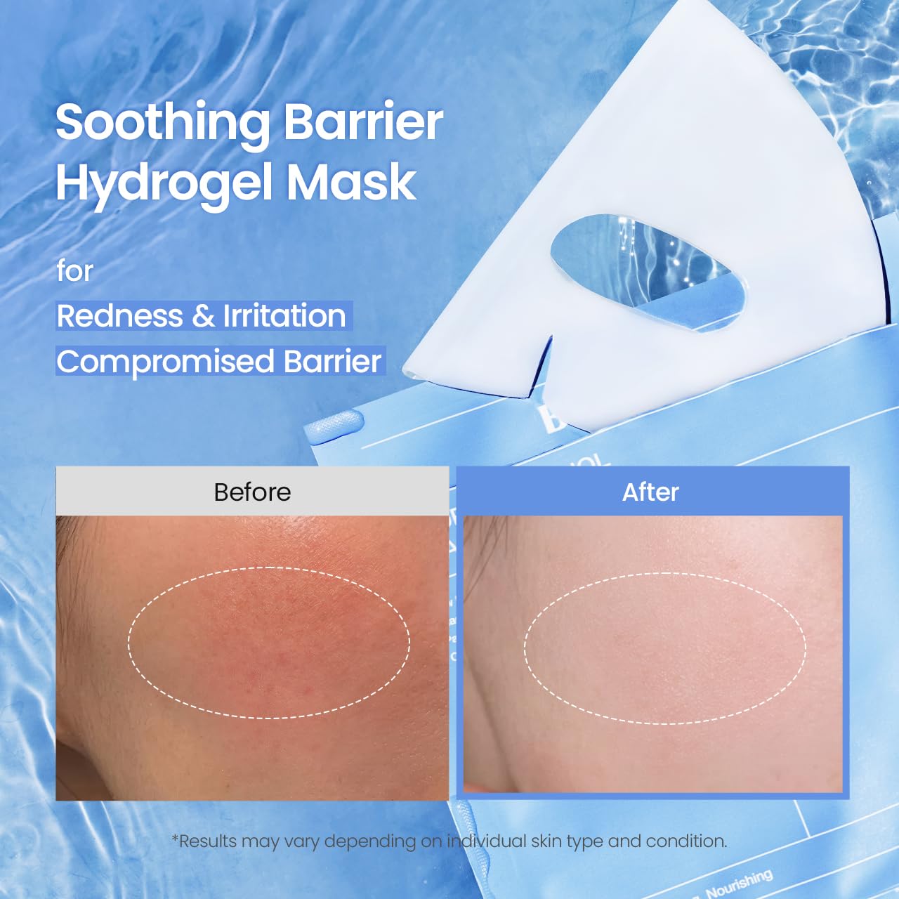 BIODANCE Bio-Collagen Real Deep Mask, Hydrating Overnight Hydrogel Face Mask, Pore Minimizing, Elasticity, Plumping, Travel Essentials & Self Care Gifts for Women, Korean Skin Care | 1.19oz(34g) x 4ea