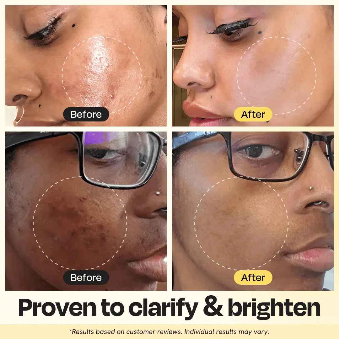 Vitamin C Clay Mask