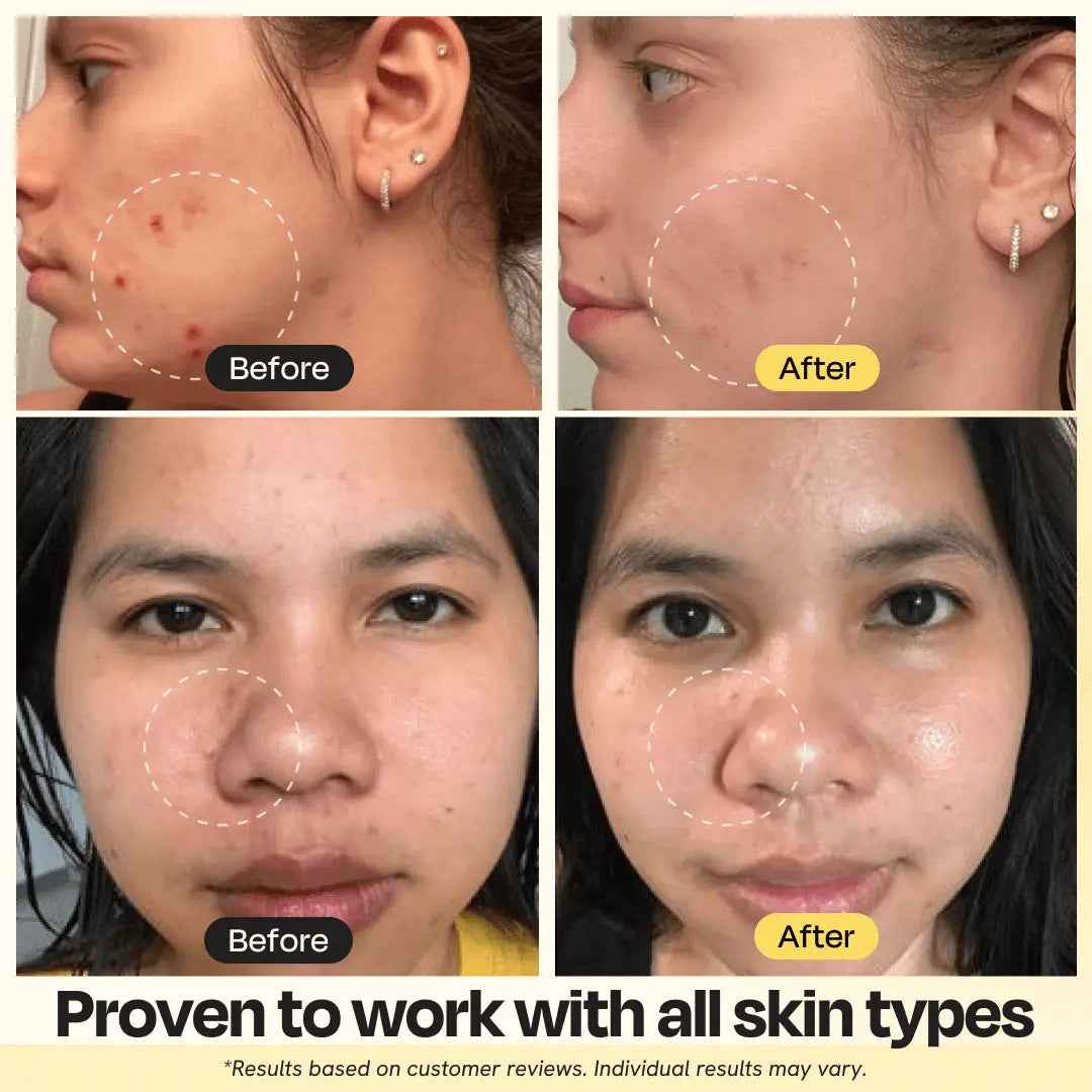 Vitamin C Clay Mask