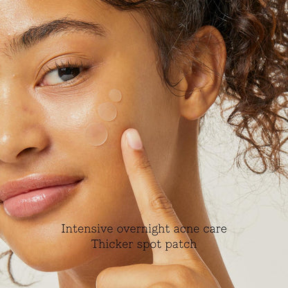 Adelyne's Boutique & Gifts Acne Pimple Master Patch on clear skin, showing small transparent hydrocolloid patches for acne treatment.