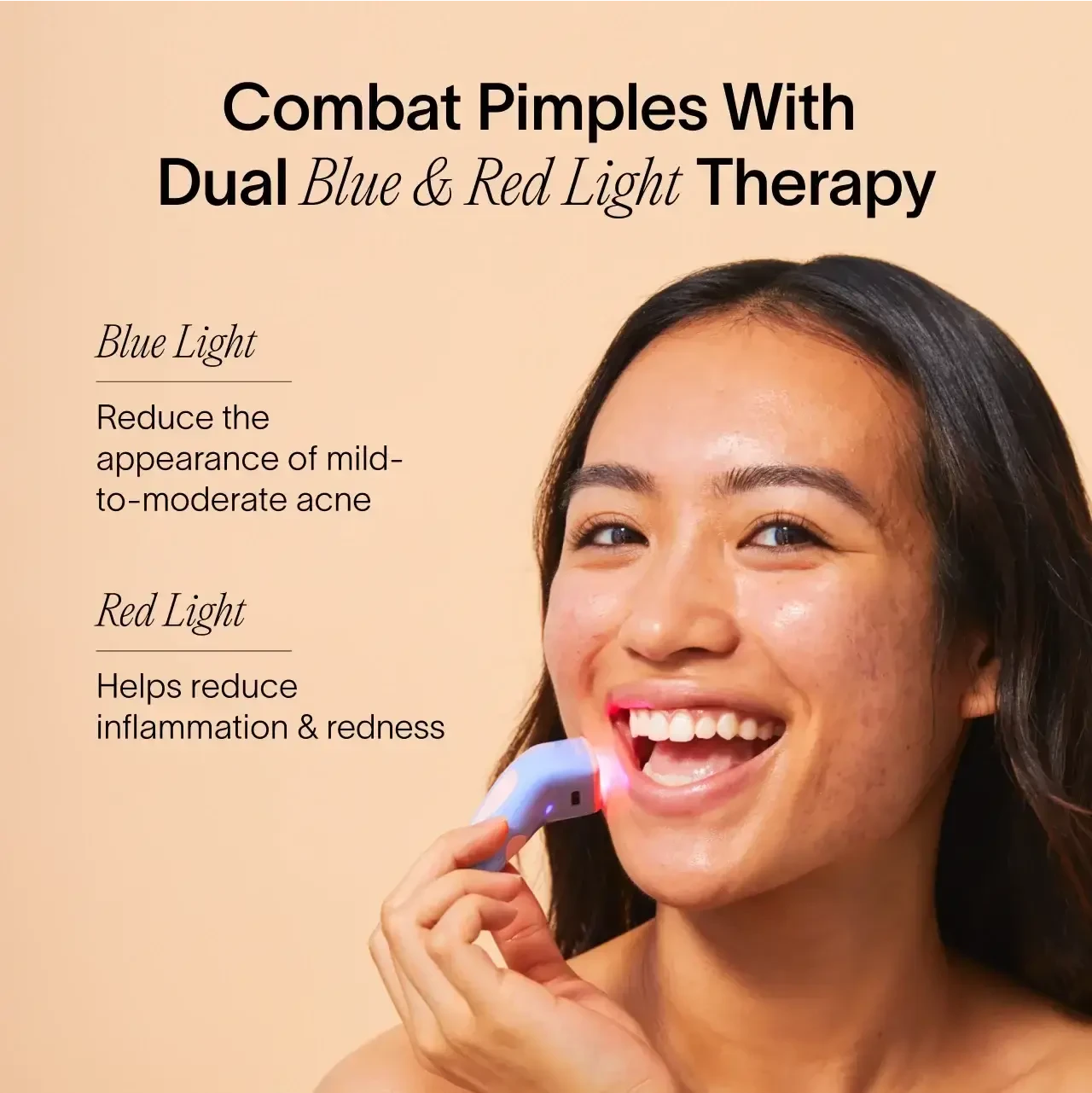 Solawave Bye Acne 3-Minute Pimple Spot Treatment skincare tool in periwinkle color, designed for quick blemish relief.