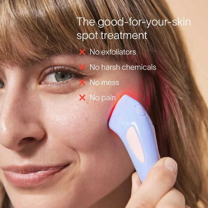 Solawave Bye Acne pimple spot treatment tool in periwinkle color, designed for quick acne spot treatment.