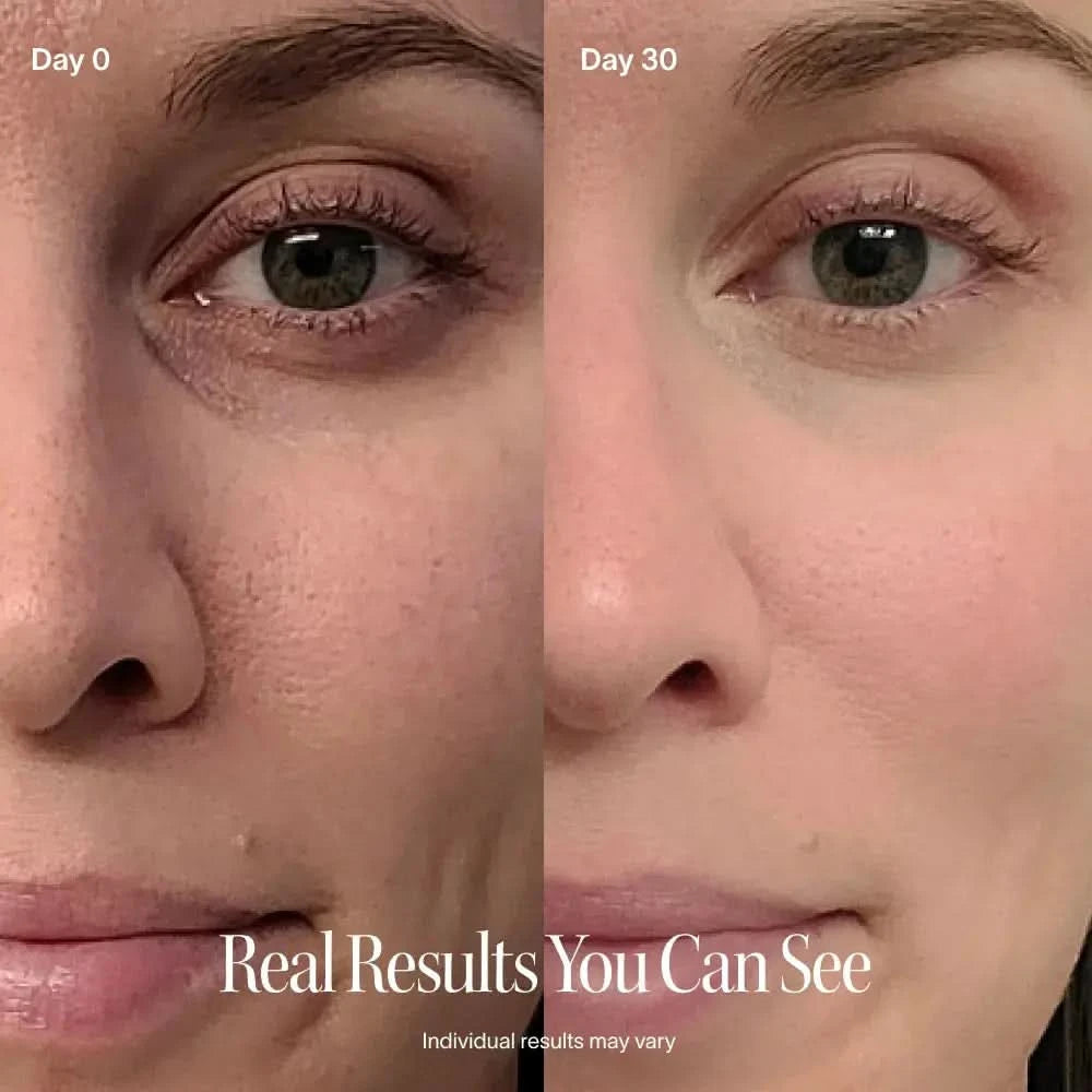 Solawave 4-in-1 red light therapy wand and activating serum kit in rose gold for skincare and facial treatment.