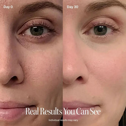 Solawave 4-in-1 red light therapy wand and activating serum kit in rose gold for skincare and facial treatment.