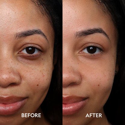 YENSA Super Bright Dark Circle Serum Peptide Corrector in a sleek eye care container with a dropper for brightening and reducing dark circles.
